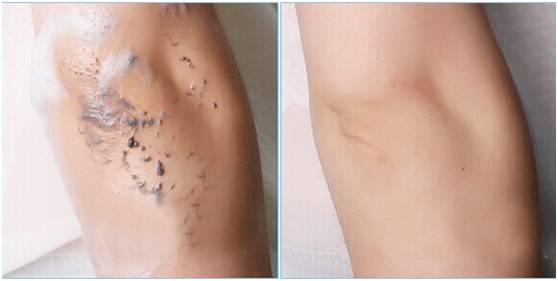 五款夏日必备的美白圣品，总有一款适合你