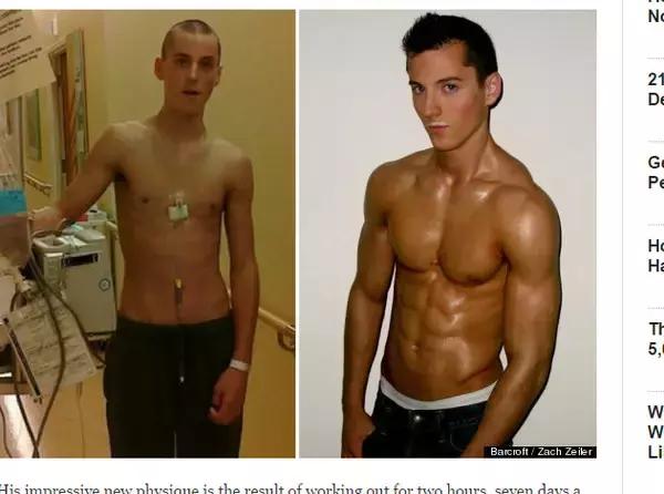 健身战胜病魔真实经历,癌症健身逆袭