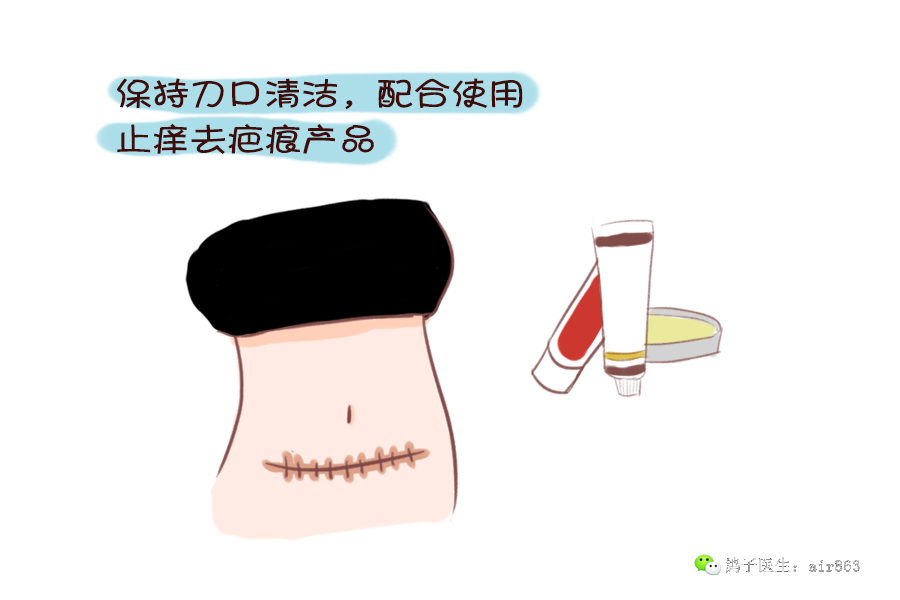 剖腹产的疤痕能完全消除吗,剖腹产留下的疤痕可以彻底消除吗