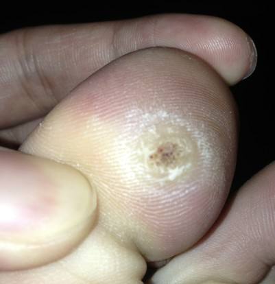 认识指甲死皮,认识足字旁