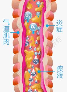 至简清肺仪对肺气肿人有效吗,肺大泡或肺气肿能不能使用清肺仪