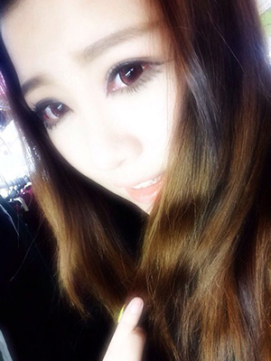 双眼皮手术后修复视频,双眼皮手术恢复记录视频