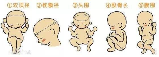 我跟B超杠上了！这一篇是专业性很强的文章！