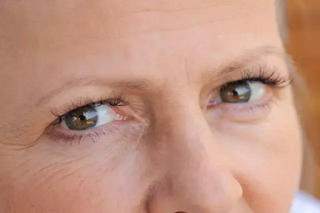 不用眼霜后果,不用眼霜的人注定老得快