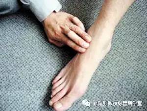 得了脉管炎可以吃韭菜吗,脉管炎怎么解决