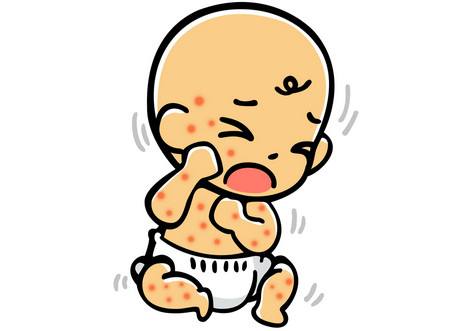 9个月宝宝发烧后出疹子怎么处理,九个月宝宝出疹子发烧怎么处理
