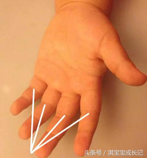 宝宝口臭就是上火了吗,宝宝口臭是因为鼻子不通气吗