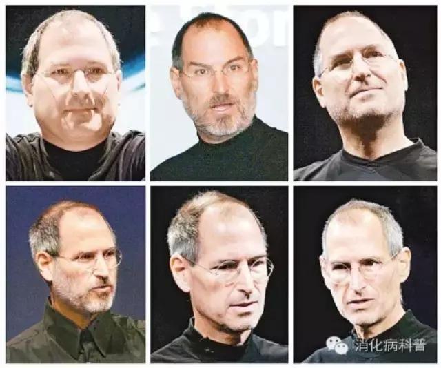 乔布斯的抗癌历程,乔布斯的抗癌经历