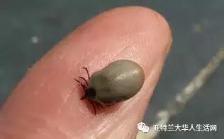 咬到嘴边肉和中风前兆有关系吗,舌头被牙齿咬到是脑中风的前兆吗