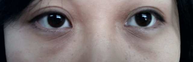 去眼周细纹最好眼霜,眼周干燥干纹用什么眼霜