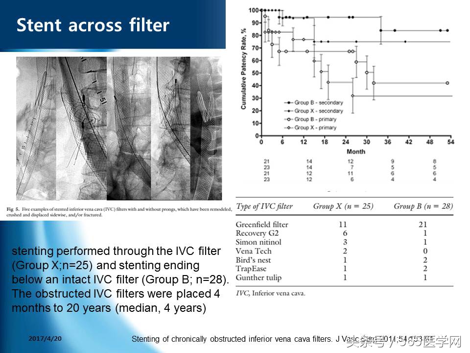 下肢静脉血栓植入滤器后的护理,下肢静脉血栓滤器植入后注意事项