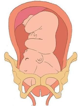 胎儿入盆的感觉有哪些,38周入盆的特征