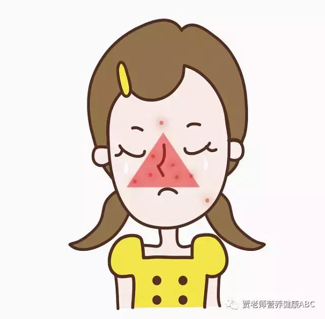 十年战痘的真实经验,战痘只需要这5招