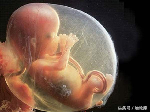 胎位不正绕脐带一圈的纠正方法,注意脐带护理