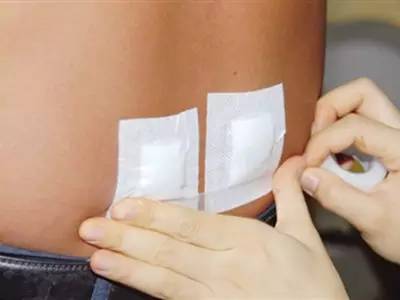 刮痧治疗过敏性鼻炎视频,刮痧放血治鼻炎