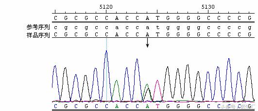 神经内科疾病诊断公式,神经系统疾病的诊断思路及步骤