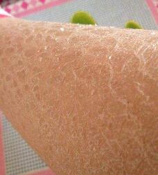 皮肤干燥脱皮起白屑是什么原因,皮肤干燥脱皮过敏怎么办