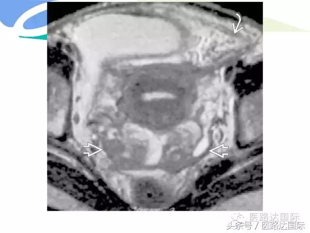 北京妇产医院梁宇霆,北京妇产医院梁宇霆出诊