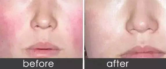 如何去除红痕,怎么去除红颜料