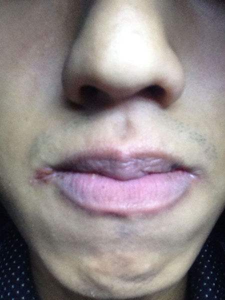 中医养生调理唇色怎么样,中医养生之道如何从唇色看健康