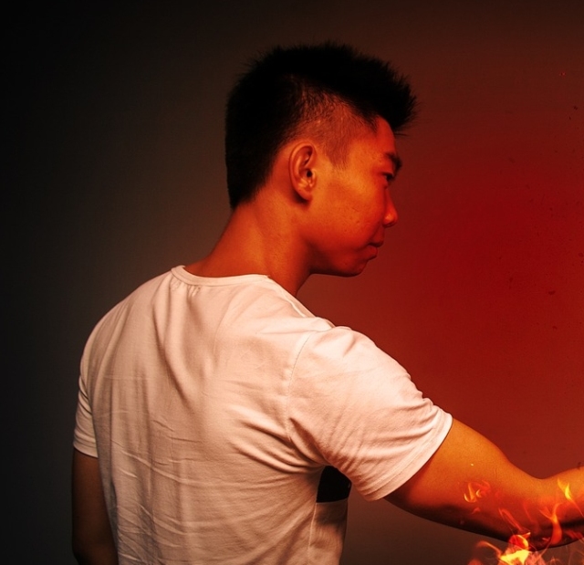 血糖控制不好糖尿病也能引起肩周炎