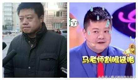 眼袋大的原因和去眼袋方法,眼袋重显老去眼袋的方法