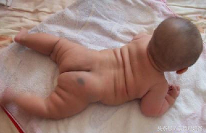 宝宝一出生脸上有一块褐色的胎记,婴儿有青色胎记是怎么回事