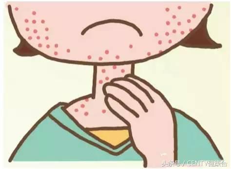 舒淇过敏化妆视频教程,舒淇皮肤敏感恢复