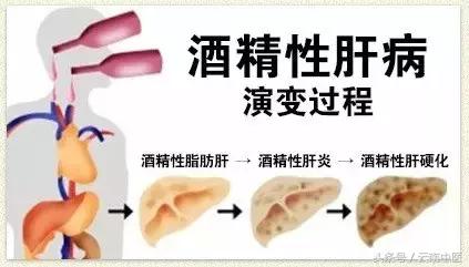 肝脏最怕5件事每做1次伤肝百倍,女性肝脏最怕的食物有哪些