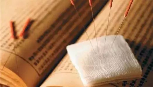 神经性耳鸣中医针灸多少钱一次,中医神经性耳鸣的最好治疗方法