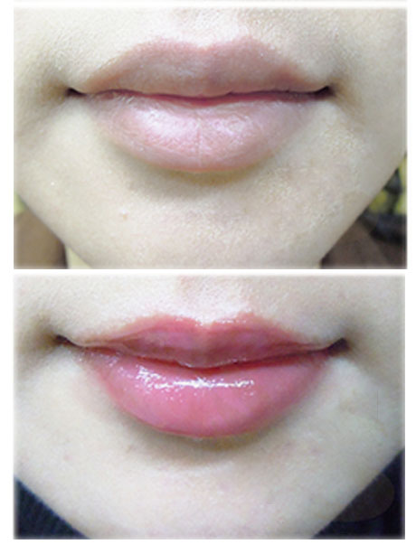 想做半永久纹唇，你要知道这10件事！