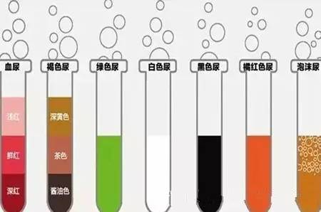 宜昌人爱吃的这种菜！3岁娃吃了两口，高烧不退，连尿尿颜色都变了……新手爸妈留意了！