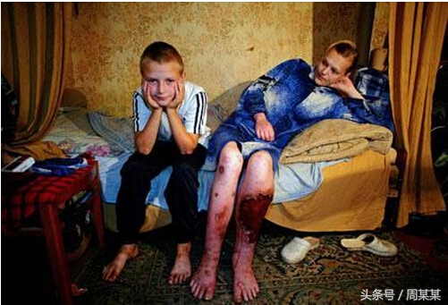 感染hiv还有活着的必要吗,感染hiv究竟应该抱有什么样的心态