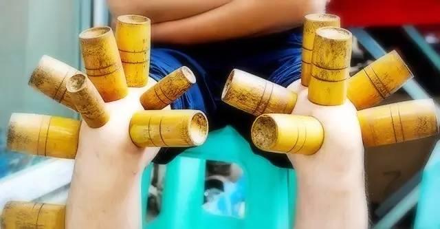 拔火罐对身体好处多还是坏处多,拔火罐对身体有哪些好处