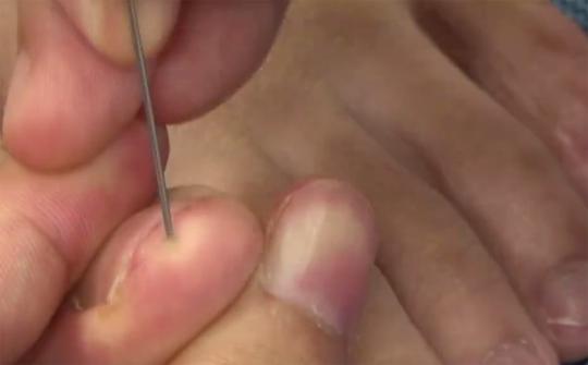 突发脑出血的10秒钟自救方法,突发脑溢血应该如何急救