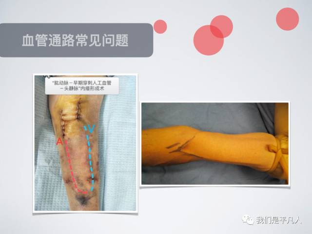 血透净化标准操作规程,血液净化基本操作技术