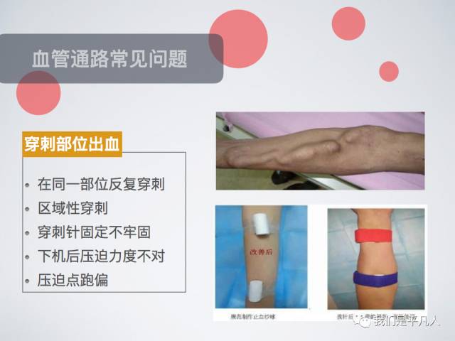 血透净化标准操作规程,血液净化基本操作技术