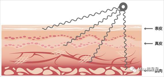 雅萌初普美容仪真的有用吗,不断问refa美容仪有效果吗