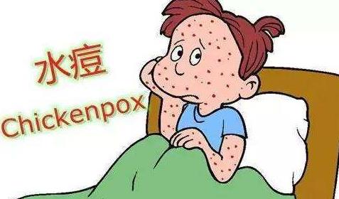 水痘高发季这波操作助你轻松战痘,水痘高发期战痘功略