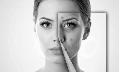 面膜用完起红疙瘩怎么回事,面膜过敏皮肤发红发痒脱皮怎么办