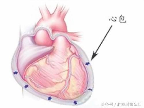 黄金昶治疗胸膜间皮瘤,黄金昶肿瘤专家著作