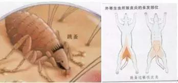 怎样给宠物驱虫以及驱虫的好处,宠物医生驱虫