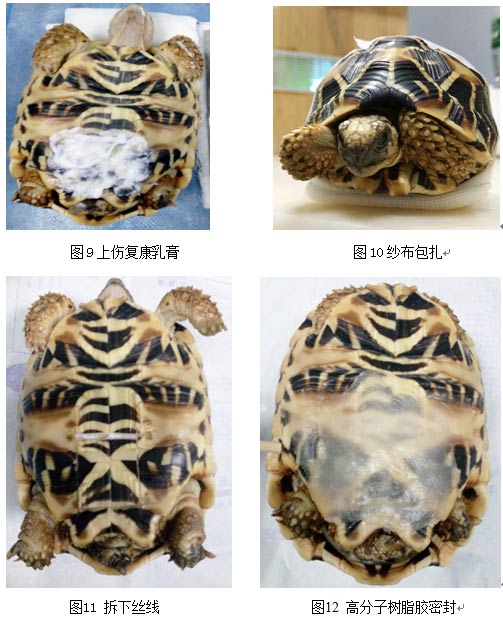 关于膀胱结石治疗方法,陆龟结石手术流程