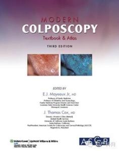 如何做宫颈激光治疗,如何做宫颈活检手术