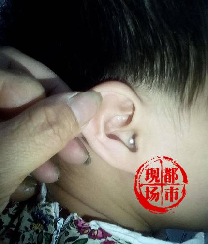 赶紧拉起宝宝耳朵看一眼父母浑身发麻！已经多次出事