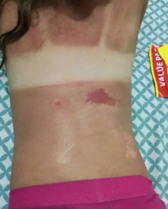 还在给宝宝海淘香蕉船防晒霜?出事了!家里有的快扔掉!