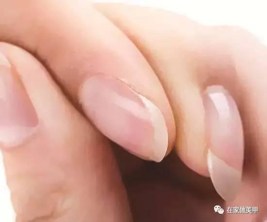 玛塔龟指甲断了,玛蒂折断手指