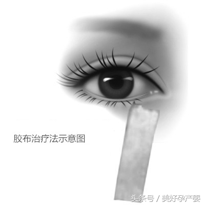 宝宝倒睫毛什么时候长好,宝宝倒睫毛是不是经常眨眼