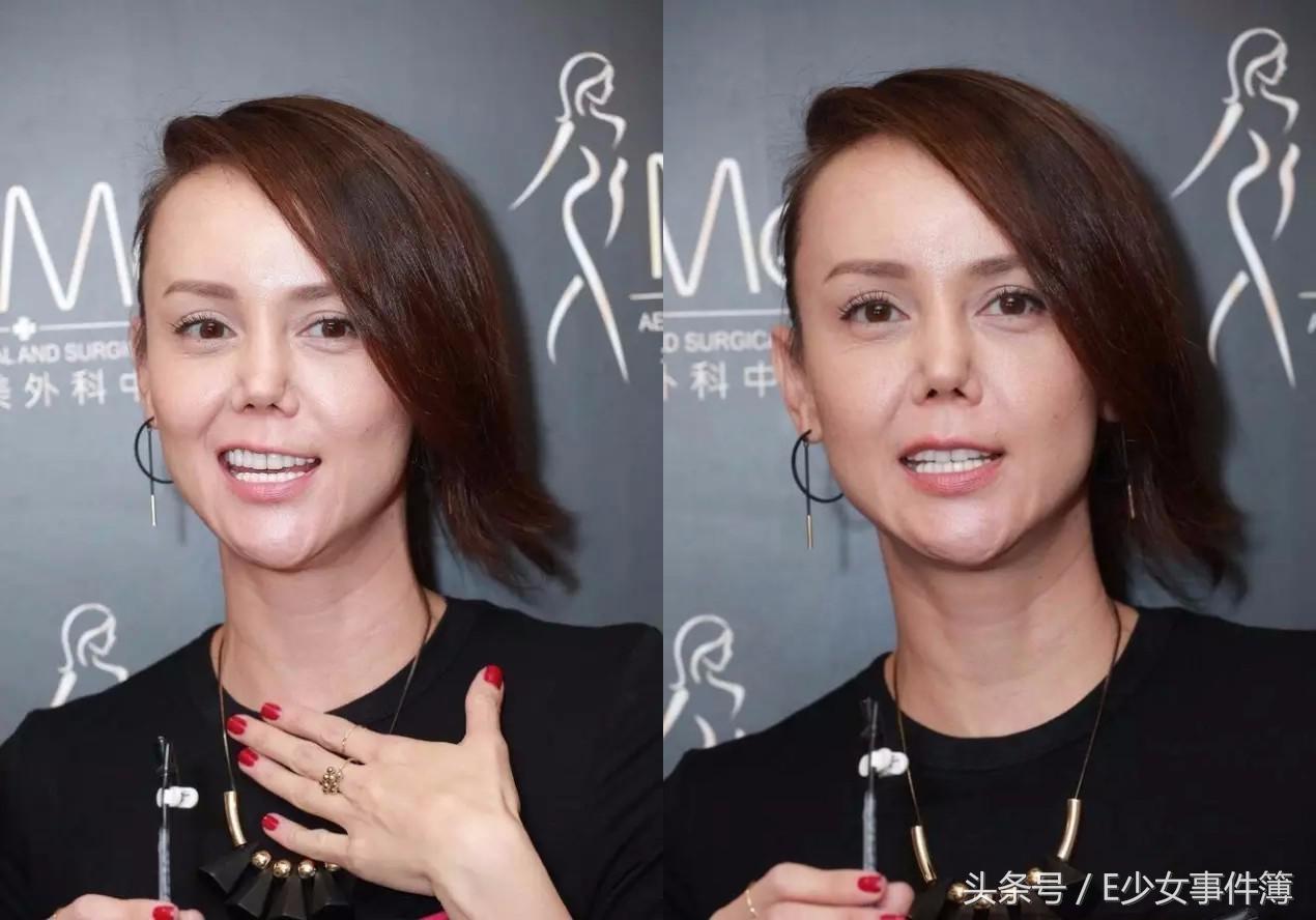 最美亚姐,韩君婷的鼻子是整容失败吗