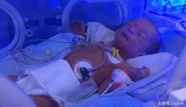 成都妈妈诞下同卵三胞胎5天准备了12包尿不湿